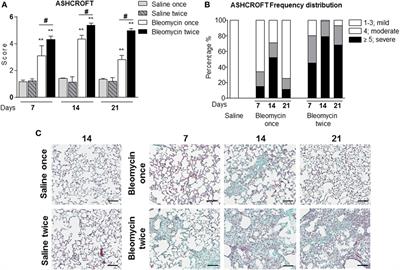 Heterologous Matrix Metalloproteinase Gene Promoter Activity Allows In Vivo Real-time Imaging of Bleomycin-Induced Lung Fibrosis in Transiently Transgenized Mice